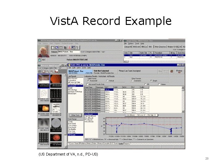 Vist. A Record Example (US Department of VA, n. d. , PD-US) 28 