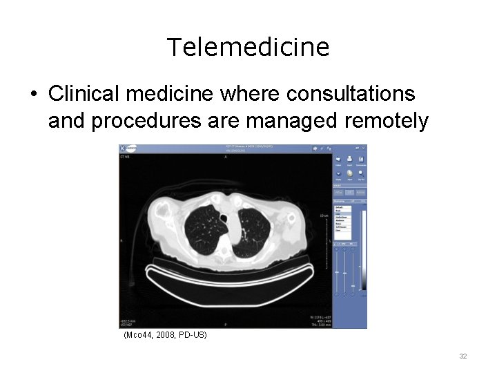 Telemedicine • Clinical medicine where consultations and procedures are managed remotely (Mco 44, 2008,