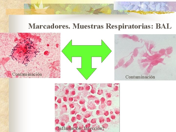 Marcadores. Muestras Respiratorias: BAL Contaminación Inflamación. Infección? 