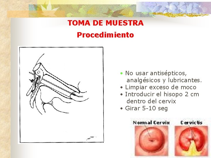 TOMA DE MUESTRA Procedimiento • No usar antisépticos, analgésicos y lubricantes. • Limpiar exceso