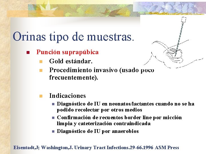 Orinas tipo de muestras. n Punción suprapúbica n Gold estándar. n Procedimiento invasivo (usado