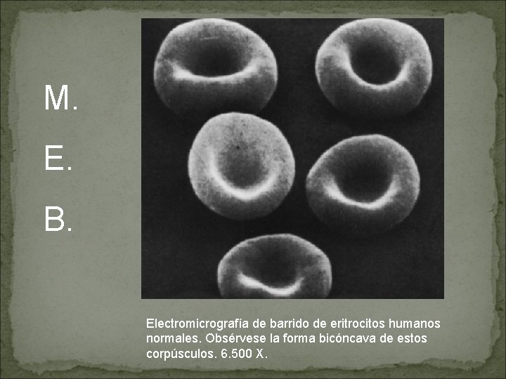 M. E. B. Electromicrografía de barrido de eritrocitos humanos normales. Obsérvese la forma bicóncava