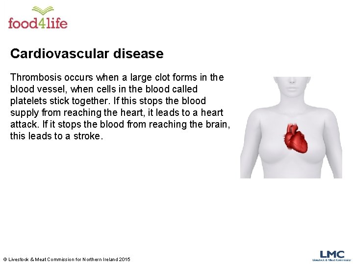 Cardiovascular disease Thrombosis occurs when a large clot forms in the blood vessel, when Cardiovascular disease Thrombosis occurs when a large clot forms in the blood vessel, when