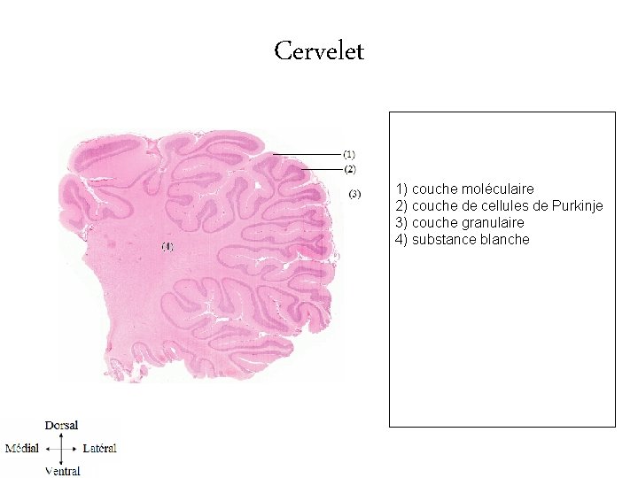 Cervelet 1) couche moléculaire 2) couche de cellules de Purkinje 3) couche granulaire 4)