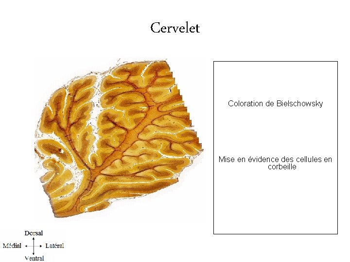 Cervelet Coloration de Bielschowsky Mise en évidence des cellules en corbeille l. 