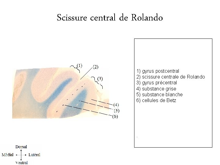 Scissure central de Rolando 1) gyrus postcentral 2) scissure centrale de Rolando 3) gyrus