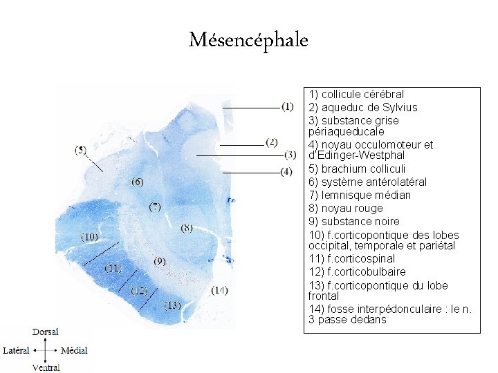 Mésencéphale 1) collicule cérébral 2) aqueduc de Sylvius 3) substance grise périaqueducale 4) noyau
