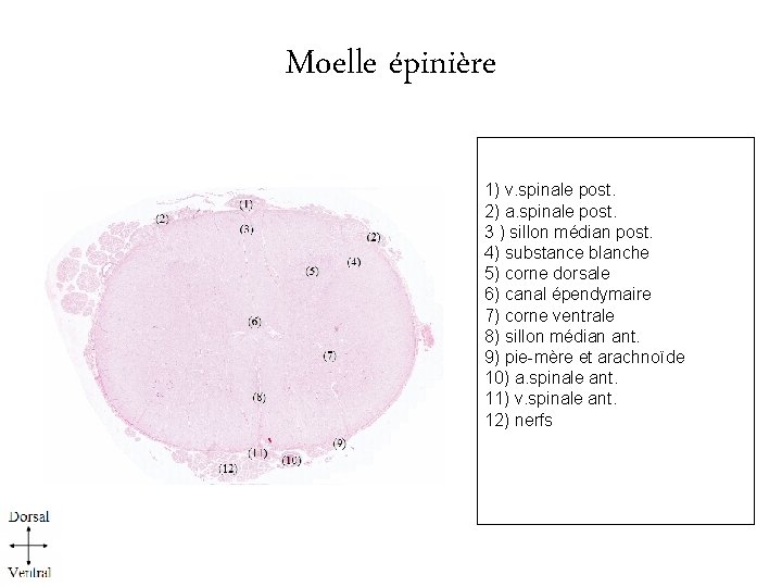 Moelle épinière 1) v. spinale post. 2) a. spinale post. 3 ) sillon médian