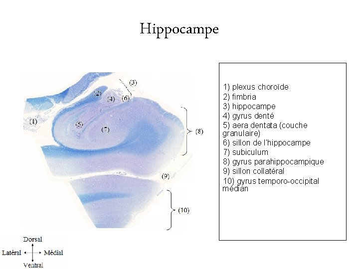 Hippocampe 1) plexus choroïde 2) fimbria 3) hippocampe 4) gyrus denté 5) aera dentata