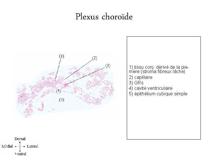 Plexus choroïde 1) tissu conj. dérivé de la piemère (stroma fibreux lâche) 2) capillaire