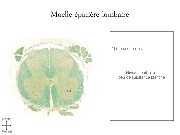 Moelle épinière lombaire 1) motoneurones Niveau lombaire : peu de substance blanche l. 