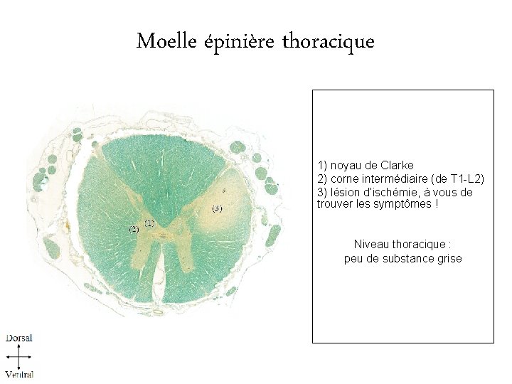 Moelle épinière thoracique 1) noyau de Clarke 2) corne intermédiaire (de T 1 -L