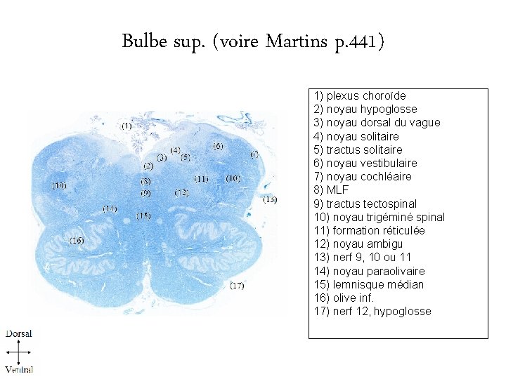 Bulbe sup. (voire Martins p. 441) 1) plexus choroïde 2) noyau hypoglosse 3) noyau