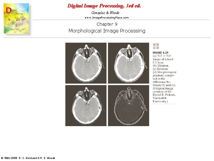 Digital Image Processing, 3 rd ed. Gonzalez & Woods www. Image. Processing. Place. com