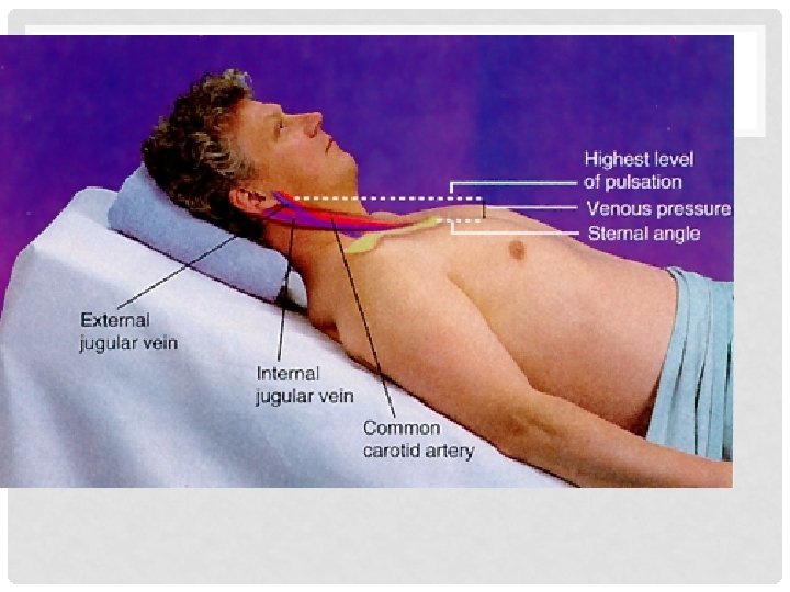  • Top line – level of the higest visible point of distention •
