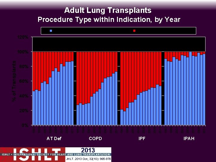 Adult Lung Transplants Procedure Type within Indication, by Year Bilateral/Double Lung Transplant Single Lung