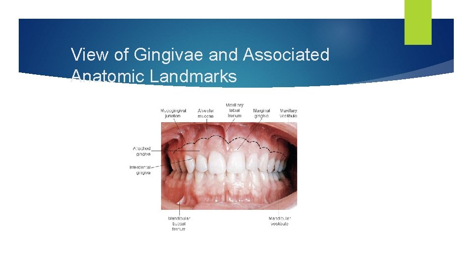 View of Gingivae and Associated Anatomic Landmarks 