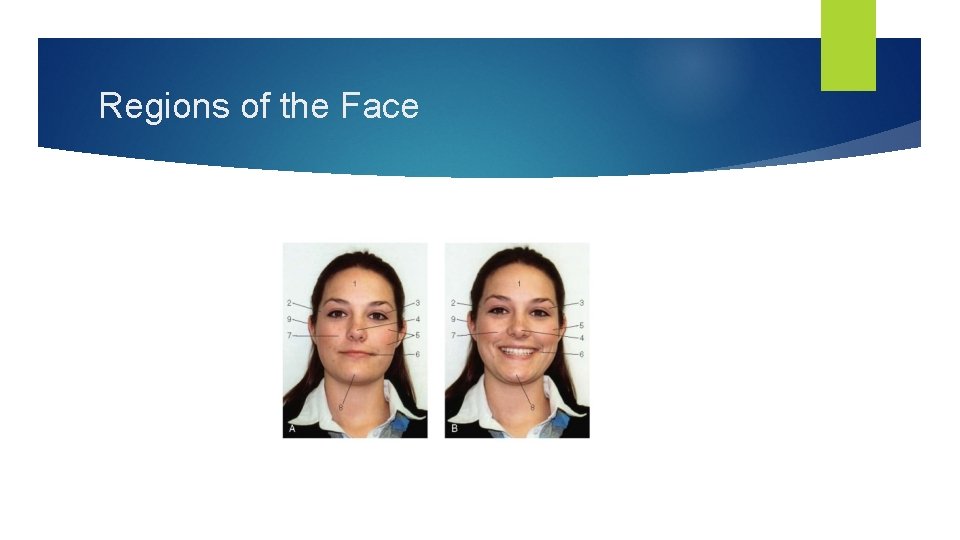 Regions of the Face 