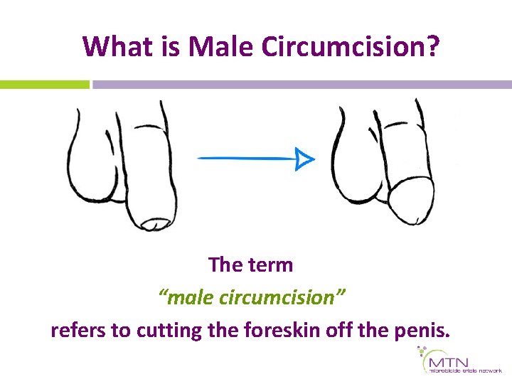 What is Male Circumcision? The term “male circumcision” refers to cutting the foreskin off