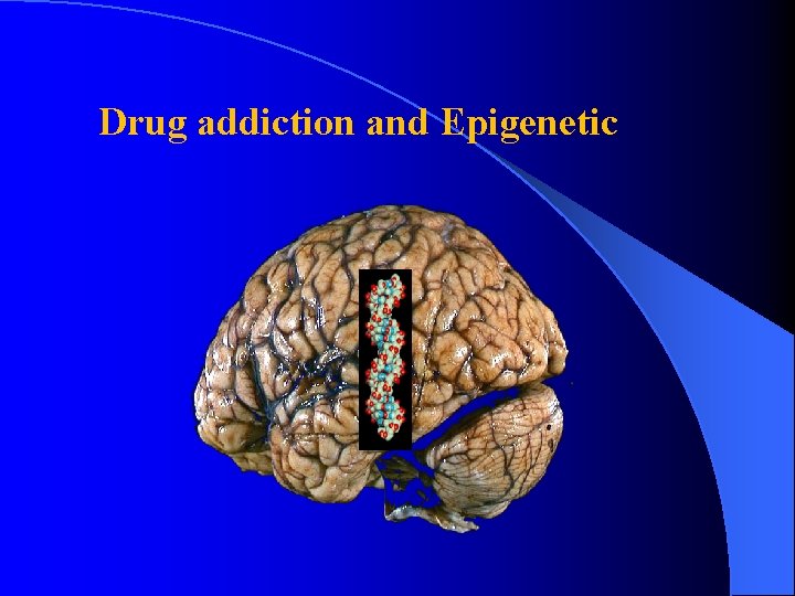 Drug addiction and Epigenetic 