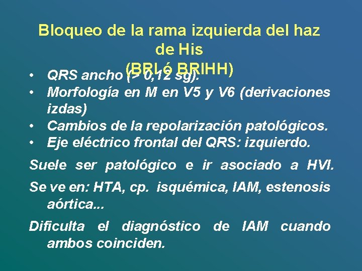 Bloqueo de la rama izquierda del haz de His (BRI ó BRIHH) • QRS Bloqueo de la rama izquierda del haz de His (BRI ó BRIHH) • QRS