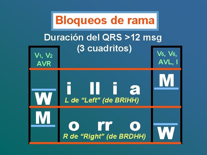 Bloqueos de rama Duración del QRS >12 msg (3 cuadritos) V 5, V 6,