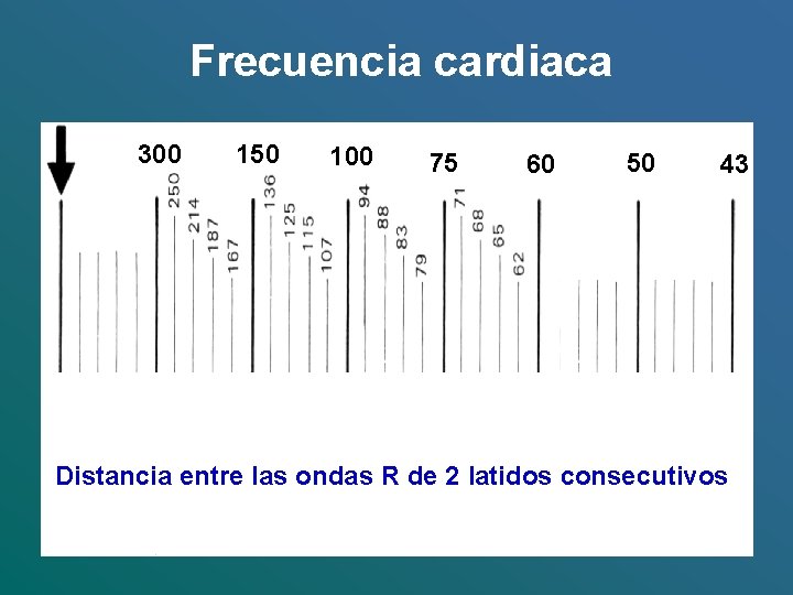 Frecuencia cardiaca 300 150 100 75 60 50 43 Distancia entre las ondas R