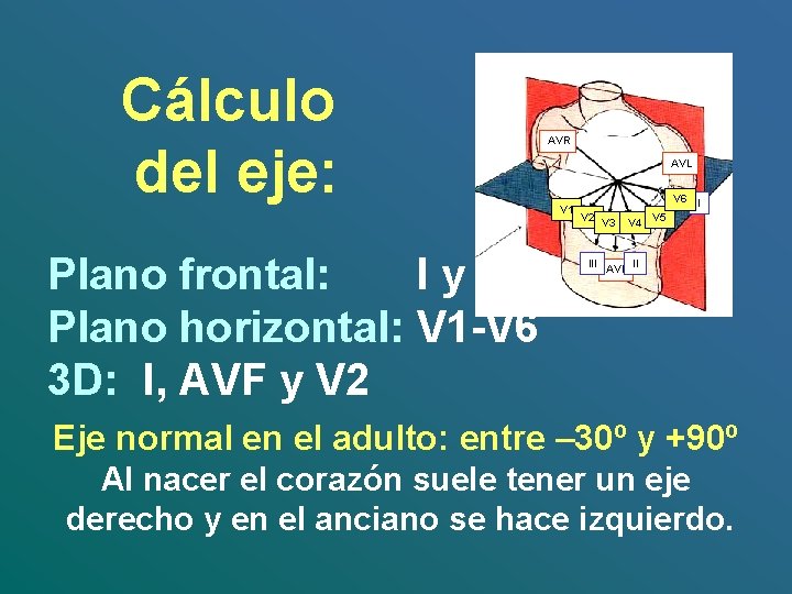 Cálculo del eje: AVR AVL V 1 Plano frontal: I y AVF Plano horizontal: