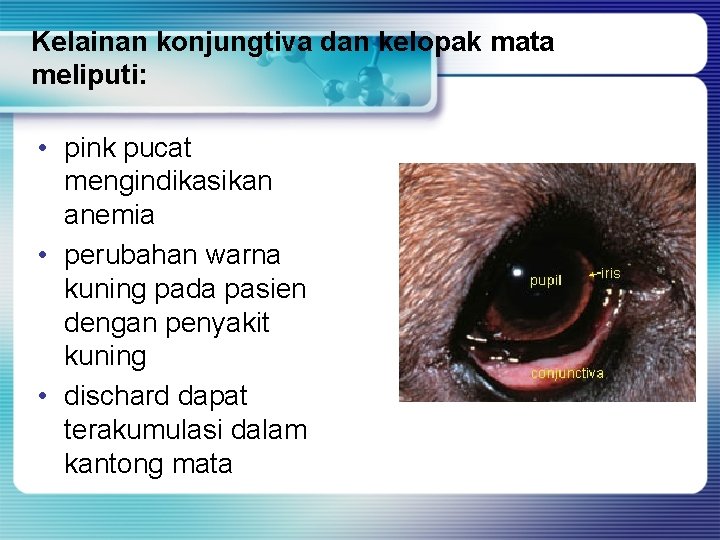 Kelainan konjungtiva dan kelopak mata meliputi: • pink pucat mengindikasikan anemia • perubahan warna Kelainan konjungtiva dan kelopak mata meliputi: • pink pucat mengindikasikan anemia • perubahan warna