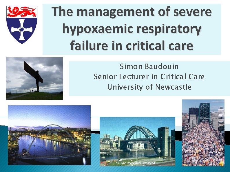 The management of severe hypoxaemic respiratory failure in critical care Simon Baudouin Senior Lecturer The management of severe hypoxaemic respiratory failure in critical care Simon Baudouin Senior Lecturer
