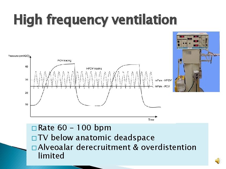 High frequency ventilation � Rate 60 – 100 bpm � TV below anatomic deadspace High frequency ventilation � Rate 60 – 100 bpm � TV below anatomic deadspace
