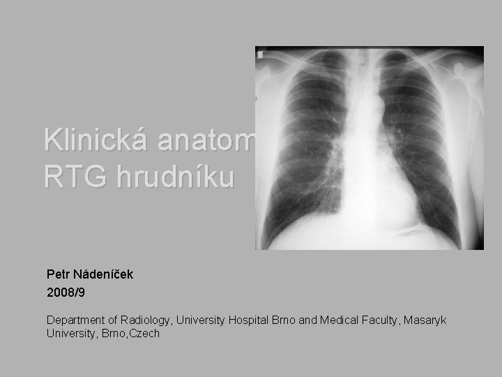 Klinická anatomie RTG hrudníku Petr Nádeníček 2008/9 Department of Radiology, University Hospital Brno and