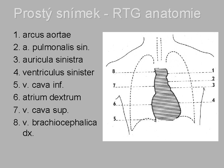 Prostý snímek - RTG anatomie 1. arcus aortae 2. a. pulmonalis sin. 3. auricula