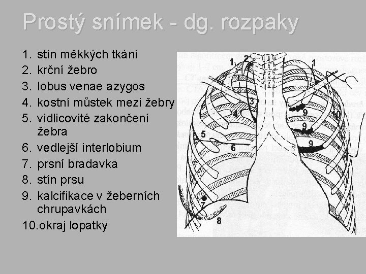 Prostý snímek - dg. rozpaky 1. 2. 3. 4. 5. stín měkkých tkání krční