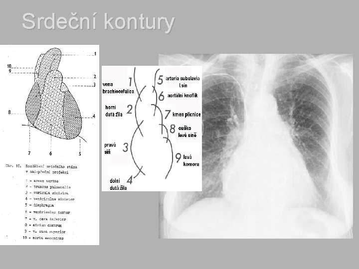 Srdeční kontury 