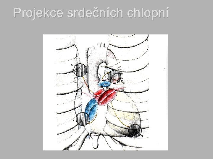 Projekce srdečních chlopní 