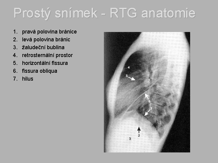 Prostý snímek - RTG anatomie 1. 2. 3. 4. 5. 6. 7. pravá polovina