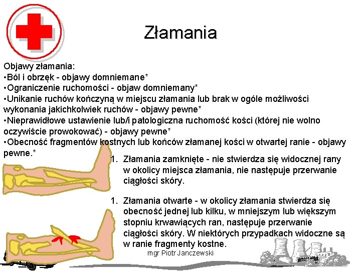 Złamania Objawy złamania: • Ból i obrzęk - objawy domniemane* • Ograniczenie ruchomości -