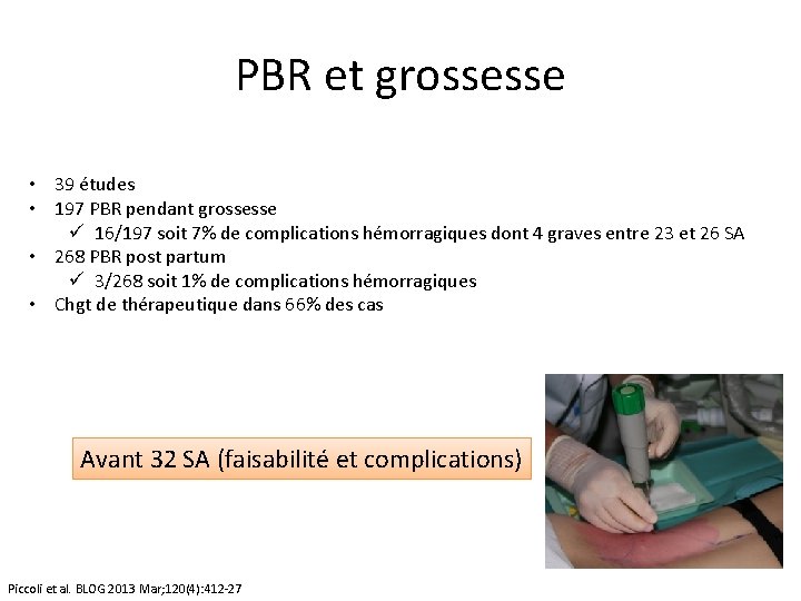 PBR et grossesse • 39 études • 197 PBR pendant grossesse ü 16/197 soit