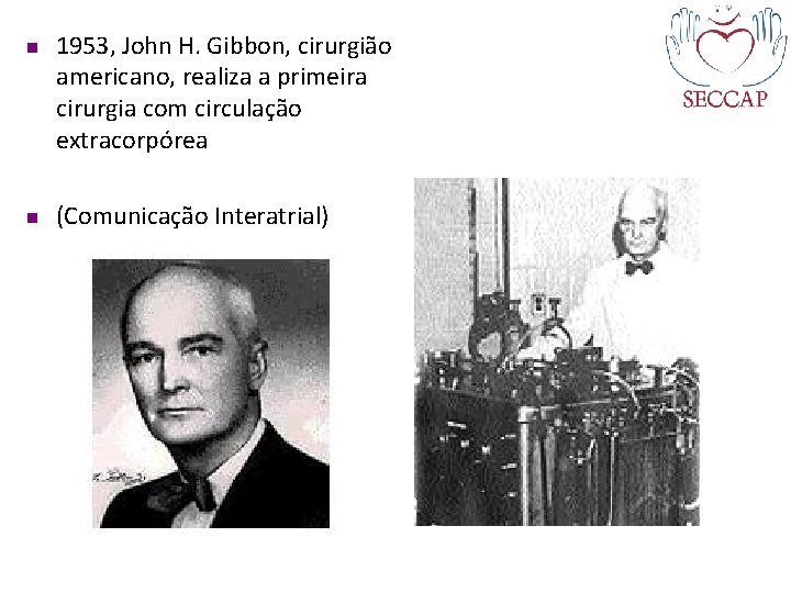 n n 1953, John H. Gibbon, cirurgião americano, realiza a primeira cirurgia com circulação