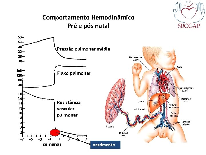 Comportamento Hemodinâmico Pré e pós natal Pressão pulmonar média Fluxo pulmonar Resistência vascular pulmonar