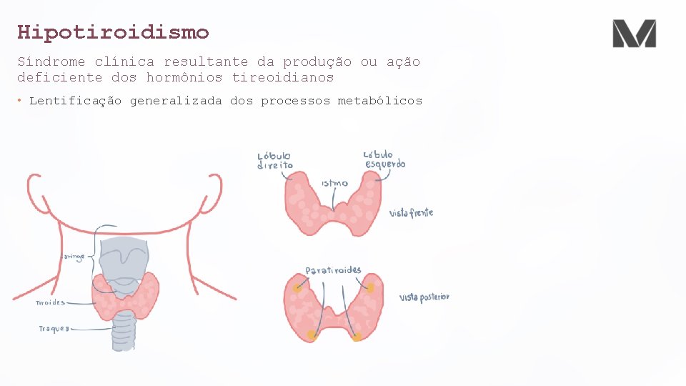 Hipotiroidismo Síndrome clínica resultante da produção ou ação deficiente dos hormônios tireoidianos • Lentificação