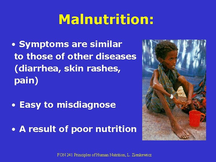 Malnutrition: • Symptoms are similar to those of other diseases (diarrhea, skin rashes, pain) Malnutrition: • Symptoms are similar to those of other diseases (diarrhea, skin rashes, pain)