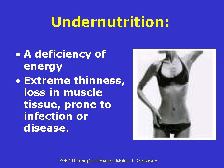 Undernutrition: • A deficiency of energy • Extreme thinness, loss in muscle tissue, prone Undernutrition: • A deficiency of energy • Extreme thinness, loss in muscle tissue, prone