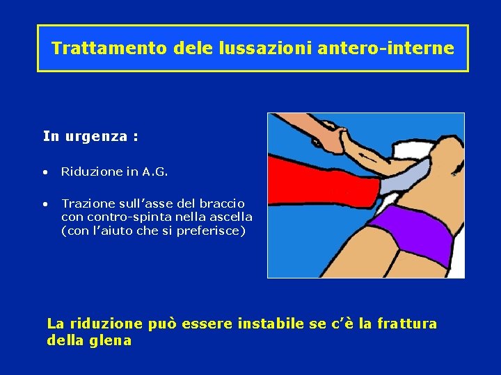 Trattamento dele lussazioni antero-interne In urgenza : • Riduzione in A. G. • Trazione