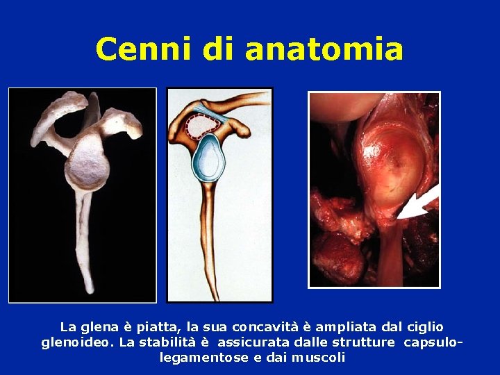 Cenni di anatomia La glena è piatta, la sua concavità è ampliata dal ciglio