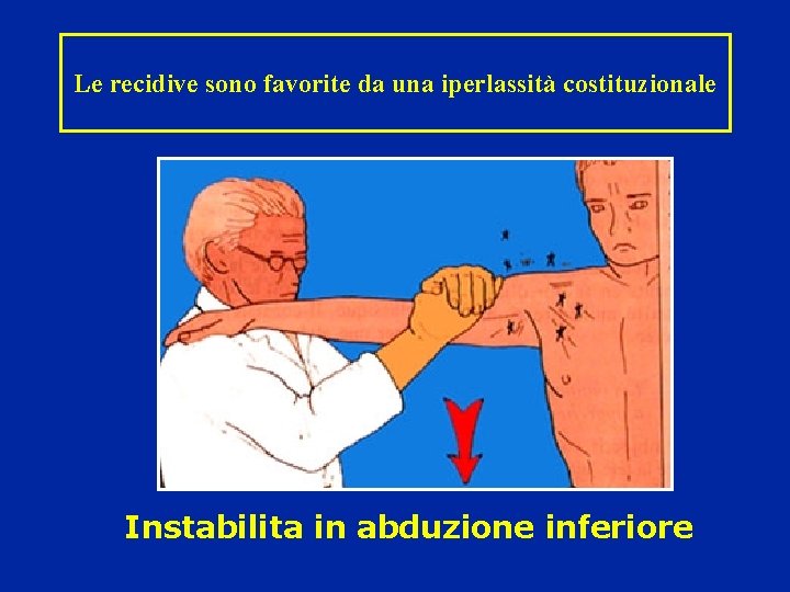 Le recidive sono favorite da una iperlassità costituzionale Instabilita in abduzione inferiore 