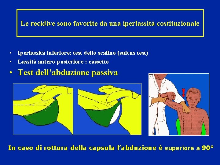 Le recidive sono favorite da una iperlassità costituzionale • Iperlassità inferiore: test dello scalino