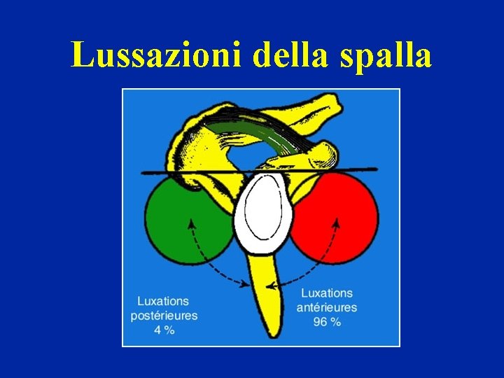 Lussazioni della spalla 