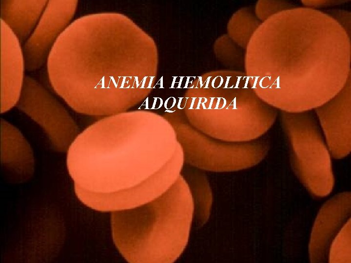 ANEMIA HEMOLITICA ADQUIRIDA 